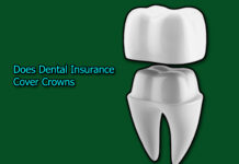 Does Dental Insurance Cover Crowns Does Dental Insurance Cover Crowns